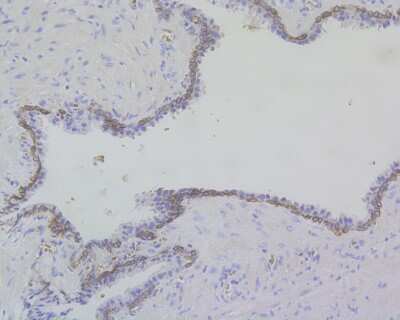 Immunohistochemistry-Paraffin: Cytokeratin 17/36 Antibody (SR45-06) [NBP2-67318]