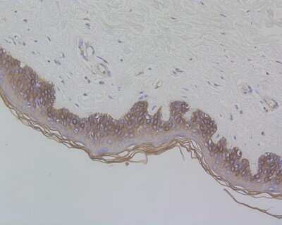 Immunohistochemistry-Paraffin: Cytokeratin 17/36 Antibody (SR45-06) [NBP2-67318]