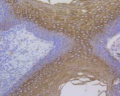 Immunohistochemistry-Paraffin: Cytokeratin 17/36 Antibody (SR45-06) [NBP2-67318]