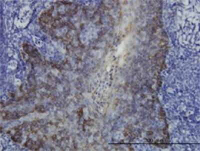 Immunohistochemistry-Paraffin: Cytokeratin 17 Antibody (2D4-1G9) [H00003872-M01]