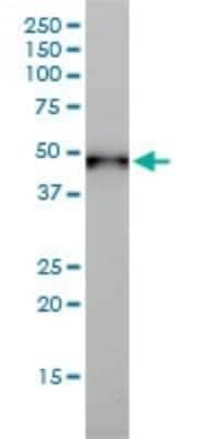 Western Blot: Cytokeratin 17 Antibody (2D4-1G9) [H00003872-M01]