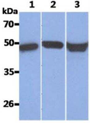 Western Blot: Cytokeratin 17 Antibody (9F3)BSA Free [NBP2-42619]