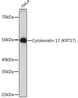 Western Blot: Cytokeratin 17 Antibody (9O6X9) [NBP3-16271]