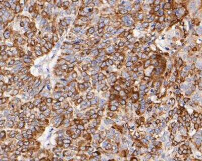 Immunohistochemistry-Paraffin: Cytokeratin 17 Antibody (A2B10) [NBP2-89123]