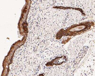 Immunohistochemistry-Paraffin: Cytokeratin 17 Antibody (A2B10) [NBP2-89123]