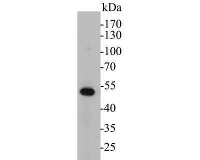 Western Blot: Cytokeratin 17 Antibody (A2B10) [NBP2-89123]