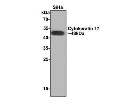 Western Blot: Cytokeratin 17 Antibody (A2B10) [NBP2-89123]