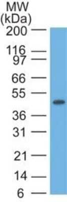 Western Blot: Cytokeratin 17 Antibody (E3 (same as Ks17.E3))Azide and BSA Free [NBP2-33188]