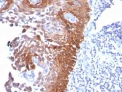 Immunohistochemistry-Paraffin: Cytokeratin 17 Antibody (E3 (same as Ks17.E3)) - IHC-Prediluted [NBP2-44425]
