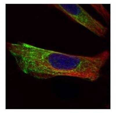 Immunocytochemistry/ Immunofluorescence: Cytokeratin 17 Antibody [NBP1-32824]