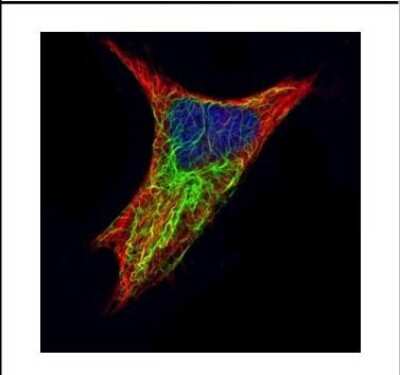Immunocytochemistry/ Immunofluorescence: Cytokeratin 17 Antibody [NBP2-16089]