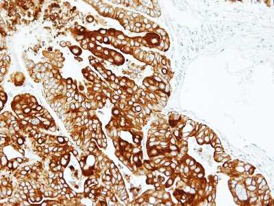 Immunohistochemistry-Paraffin: Cytokeratin 17 Antibody [NBP1-32824]