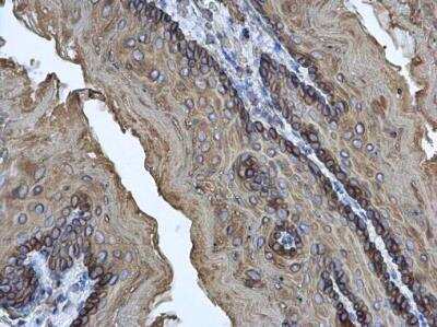 Immunohistochemistry-Paraffin: Cytokeratin 17 Antibody [NBP1-32824]