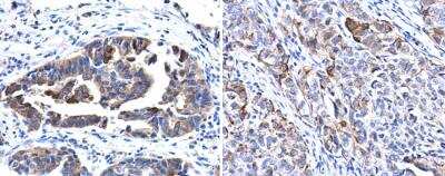 Immunohistochemistry-Paraffin: Cytokeratin 17 Antibody [NBP1-32824]