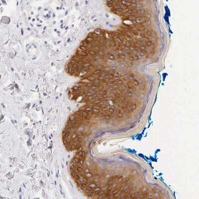 Immunohistochemistry-Paraffin: Cytokeratin 17 Antibody [NBP1-87319]