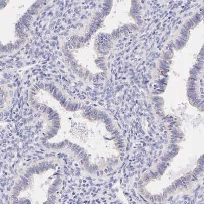 Immunohistochemistry-Paraffin: Cytokeratin 17 Antibody [NBP1-87319]