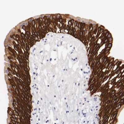 Immunohistochemistry-Paraffin: Cytokeratin 17 Antibody [NBP1-87319]