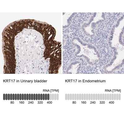 Immunohistochemistry-Paraffin: Cytokeratin 17 Antibody [NBP1-87319]