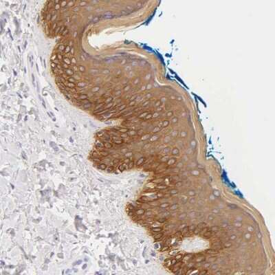 Immunohistochemistry-Paraffin: Cytokeratin 17 Antibody [NBP1-87320]
