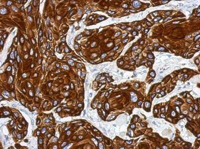Immunohistochemistry-Paraffin: Cytokeratin 17 Antibody [NBP2-16089]