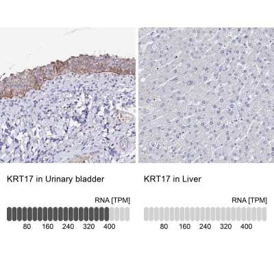 Immunohistochemistry-Paraffin: Cytokeratin 17 Antibody [NBP2-38536]