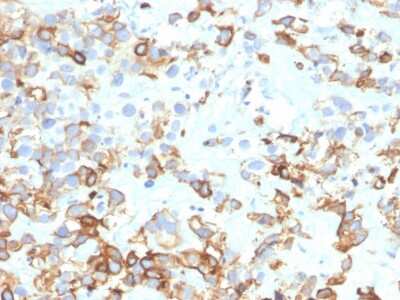 Immunohistochemistry-Paraffin: Cytokeratin 17 Antibody (KRT17/4604) - Azide and BSA Free [NBP3-08541]
