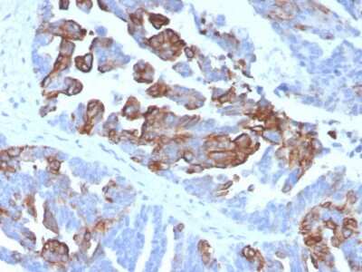 Immunohistochemistry-Paraffin: Cytokeratin 17 Antibody (KRT17/4604) - Azide and BSA Free [NBP3-08541]