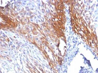 Immunohistochemistry-Paraffin: Cytokeratin 17 Antibody (KRT17/778) - Azide and BSA Free [NBP2-47684]