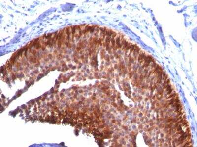 Immunohistochemistry-Paraffin: Cytokeratin 17 Antibody (KRT17/778) - IHC-Prediluted [NBP2-48047]