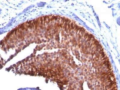 Immunohistochemistry-Paraffin: Cytokeratin 17 Antibody (KRT17/778) [NBP2-44427]