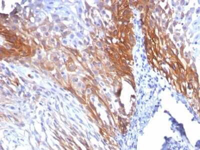 Immunohistochemistry-Paraffin: Cytokeratin 17 Antibody (KRT17/778) [NBP2-44427]