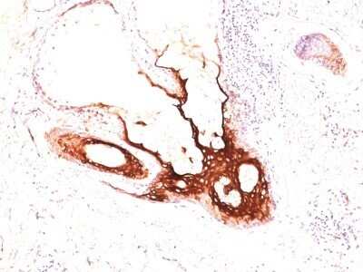 Immunohistochemistry-Paraffin: Cytokeratin 17 Antibody (SPM560) - Azide and BSA Free [NBP2-34425]