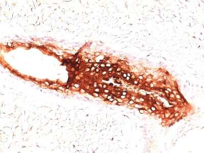 Immunohistochemistry-Paraffin: Cytokeratin 17 Antibody (SPM560) [NBP2-34378]
