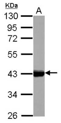 Western Blot: Cytokeratin 17 Antibody [NBP1-32824]