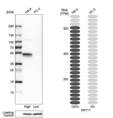 Western Blot: Cytokeratin 17 Antibody [NBP1-87319]