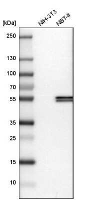 Western Blot: Cytokeratin 17 Antibody [NBP1-87320]