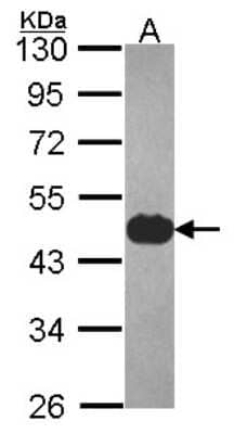 Western Blot: Cytokeratin 17 Antibody [NBP2-16089]