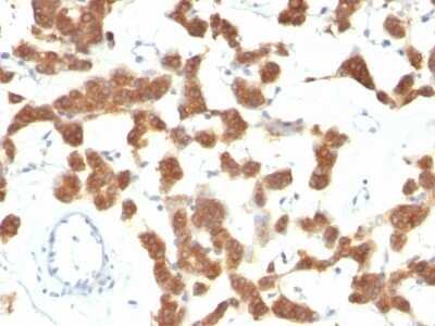 Immunohistochemistry-Paraffin: Cytokeratin 18 Antibody (B23.1) - IHC-Prediluted [NBP2-48085]