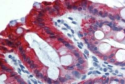 Immunohistochemistry-Paraffin: Cytokeratin 18 Antibody (C-04) - BSA Free [NB500-306]