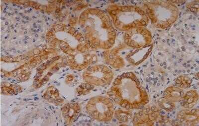 Immunohistochemistry-Paraffin: Cytokeratin 18 Antibody (C-04) - BSA Free [NB500-306]