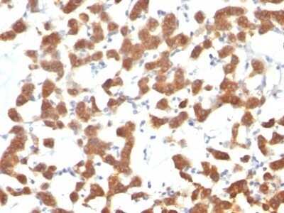 Immunohistochemistry-Paraffin: Cytokeratin 18 Antibody (C-04 (same as Ks18.04)) - IHC-Prediluted [NBP2-48075]