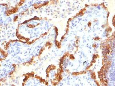 Immunohistochemistry-Paraffin: Cytokeratin 18 Antibody (Cocktail) - Azide and BSA Free [NBP2-47978]