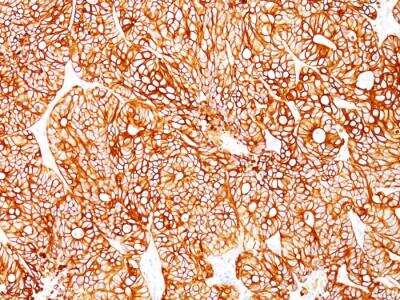 Immunohistochemistry-Paraffin: Cytokeratin 18 Antibody (Cocktail) - Azide and BSA Free [NBP2-47978]