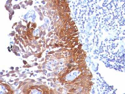 Immunohistochemistry-Paraffin: Cytokeratin 18 Antibody (Cocktail) - Azide and BSA Free [NBP2-47978]