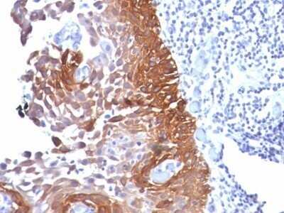 Immunohistochemistry-Paraffin: Cytokeratin 18 Antibody (Cocktail) - IHC-Prediluted [NBP2-48076]