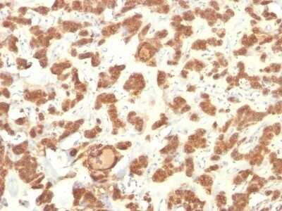 Immunohistochemistry-Paraffin: Cytokeratin 18 Antibody (Cocktail) - IHC-Prediluted [NBP2-48076]