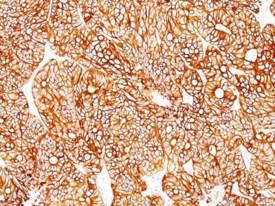 Immunohistochemistry-Paraffin: Cytokeratin 18 Antibody (Cocktail) - IHC-Prediluted [NBP2-48076]