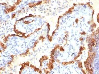 Immunohistochemistry-Paraffin: Cytokeratin 18 Antibody (Cocktail) - IHC-Prediluted [NBP2-48076]