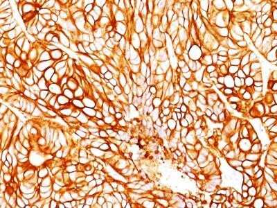 Immunohistochemistry-Paraffin: Cytokeratin 18 Antibody (DA7) - Azide and BSA Free [NBP2-33176]