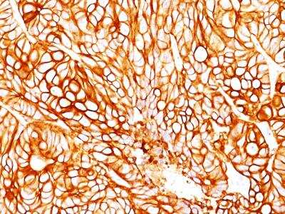 Immunohistochemistry-Paraffin: Cytokeratin 18 Antibody (DA7) [NBP2-29409]